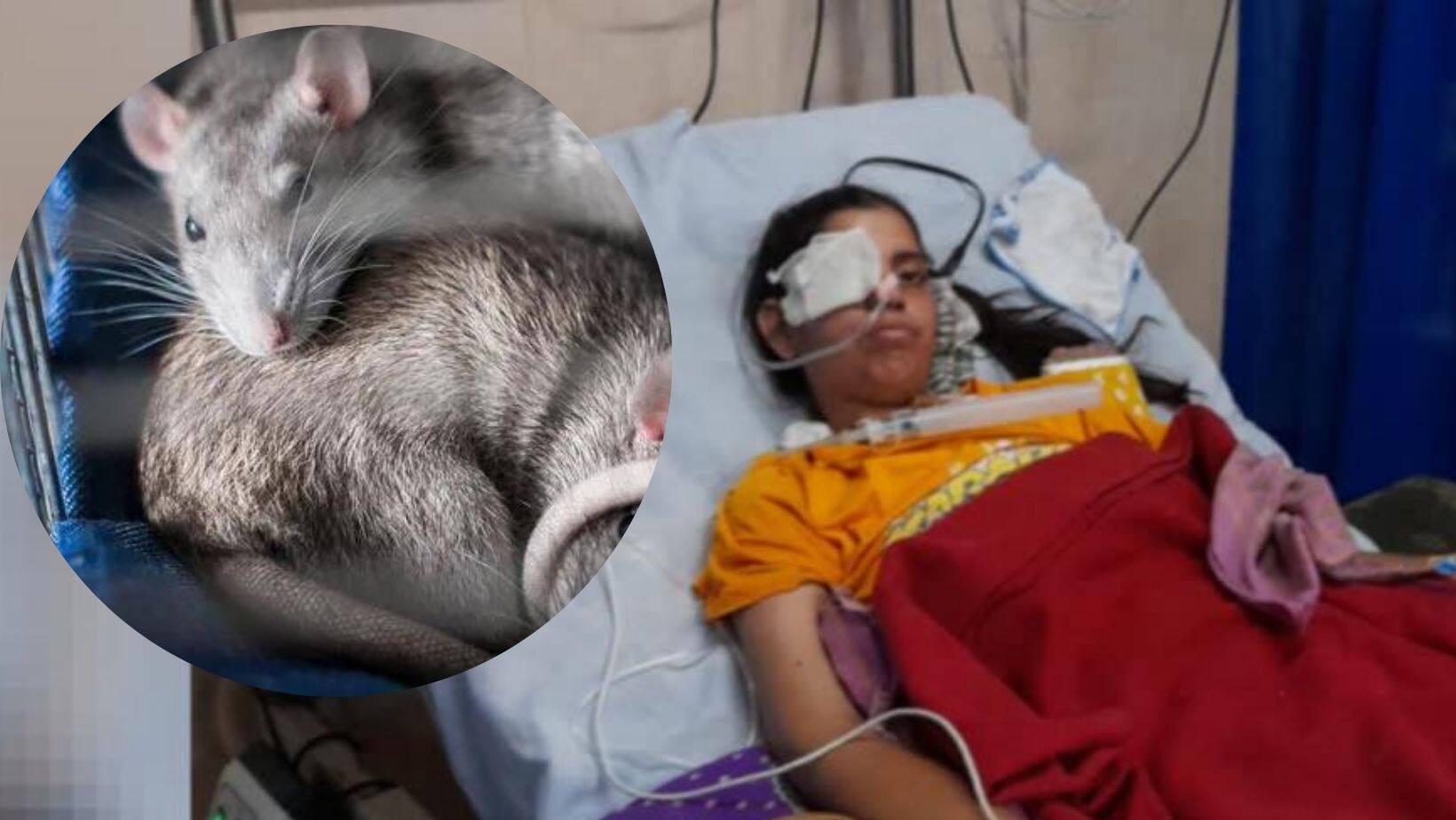 Rajasthan Woman's Eyelids Nibbled By Rats In ICU: What to Know About Rat Bite